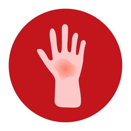 First Aid for Burns American Survivalist