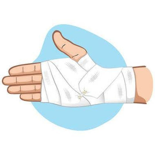 First Aid for Minor Burns American Survivalist